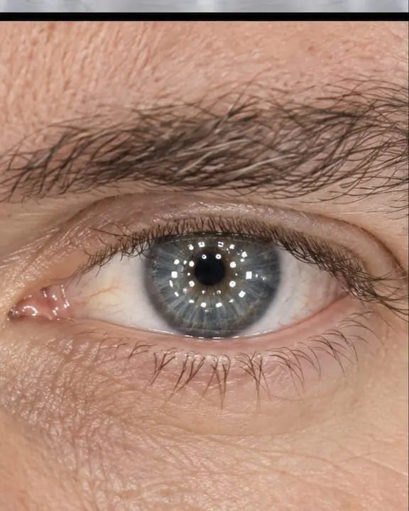 Extreme close-up of a man's eye with hundreds of tiny reflected light points scattered across the iris
